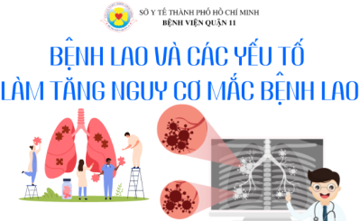 (HCDC) Bệnh lao và các yếu tố làm tăng nguy cơ mắc bệnh lao